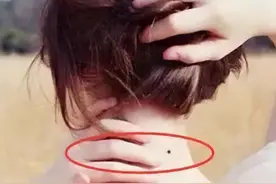 孩子身上这几个“痣”，或是“好福气”的寓意，你家孩子有几个？图片
