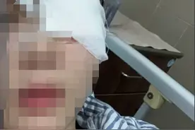 女子泼水节上被高压水枪喷伤眼睛住院，发视频谴责粗野行为；官方：景区禁售高压水枪，总有游客不听图片