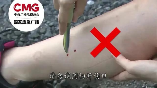 安徽一男子走路玩手机，一脚踩中互相打斗的竹叶青和五步蛇！脚被竹叶青咬两口，五步蛇咬一口