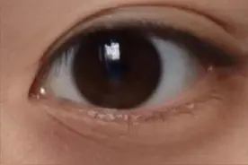 没熬夜为啥也长黑眼圈？不同颜色反映不同身体问题，进来自测图片