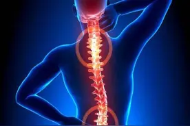 脊柱侧弯的成因是什么？有哪些信号？图片