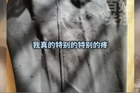 六年级女生被同桌霸凌：大腿被扎了218针！教体局回应令人寒心！图片