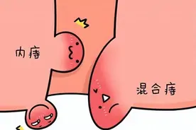 有“痔”青年要学会这个药，清热利湿，通便清肠道，止痛又止血！图片