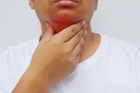 感冒不止是感冒！你知道吗？病毒性和细菌性咽喉炎，影响治疗效果图片