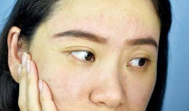 女人有没有妇科病，看脸就知道？脸上有几种表现，说明你要当心了