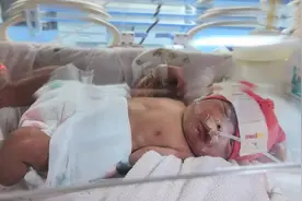 和济医院喜迎四对双胞胎宝宝图片