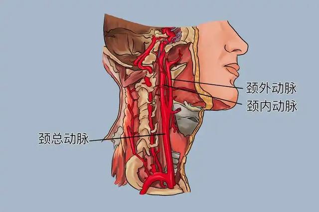 颈动脉狭窄,头脑先知,注意5种症状,或是颈动脉斑块的早期信号