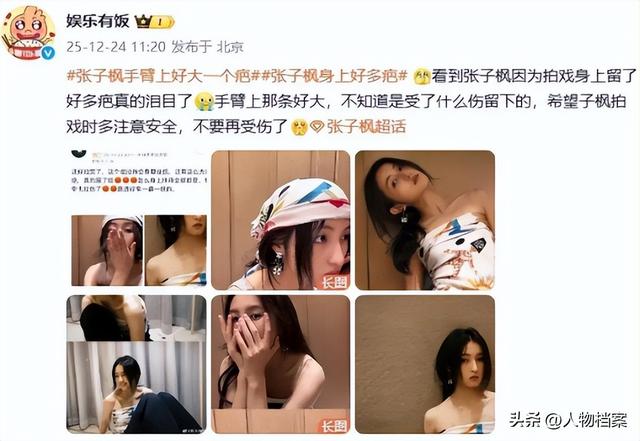 张子枫丝巾裹胸，曝浑身伤痕胸前、手臂都有，才懂成龙话的含金量