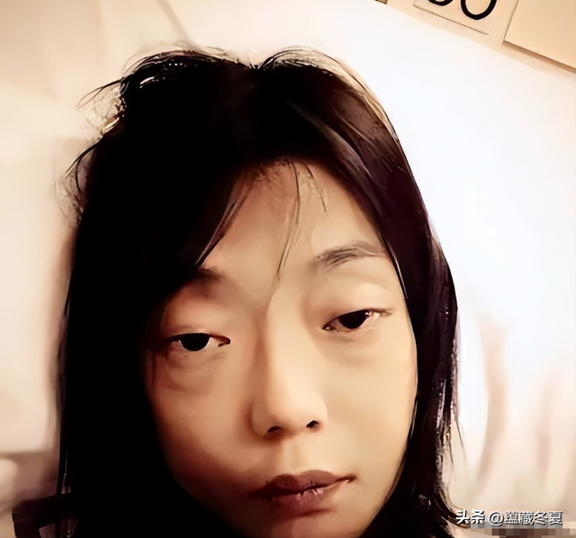 一代女神沦为豪门玩物？结婚8年牙齿全掉，器官切除，面似骷髅