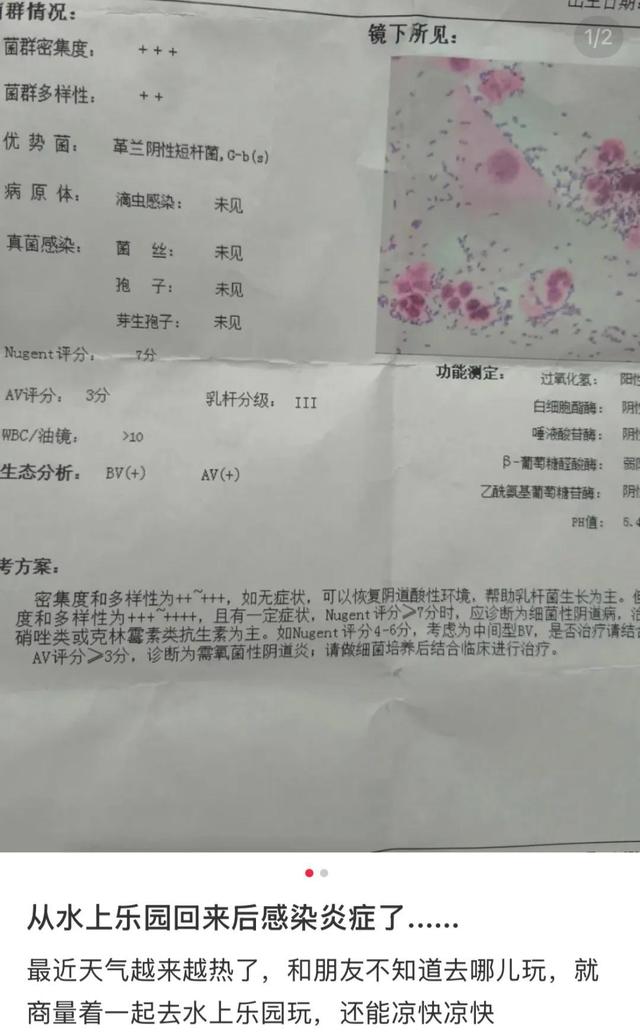 比厕所还脏，比砒霜毒！暑假“遛娃”圣地，居然藏着妇科病危机？