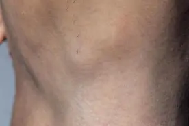 洗澡的时候摸一摸，有些癌症自己就能摸出来，八个地方要留意图片