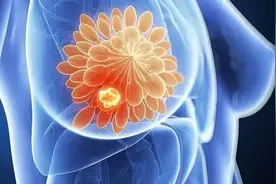 带您了解乳腺结节，从此解开您的心结！图片