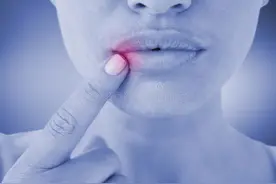 反复咳嗽、咽痛怎么缓解？除了多喝水，还有这些办法图片