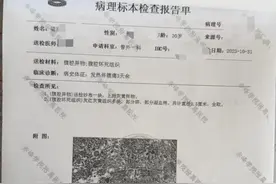 一男子阑尾炎手术15个月后在体内发现纱布，当地医调委已介入图片