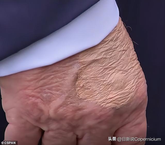 美斡旋后俄乌局势为何仍没出现好转
