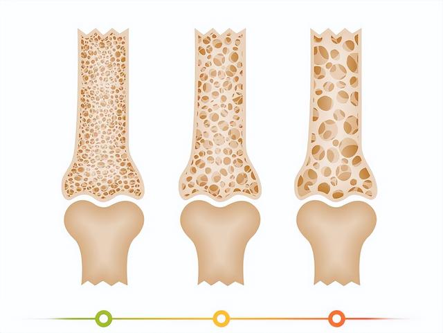 48 岁男子练引体向上 ，复查骨密度提升，这4个动作中老年人也能做