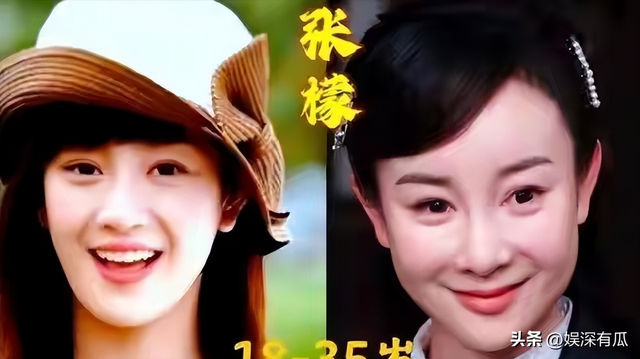 直到看见39岁嘴歪脸僵，还发腮的江疏影，才知道马伊琍的话没错！