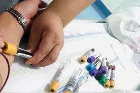 得强直性脊柱炎后如何缓解图片