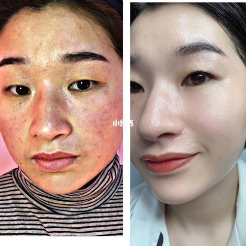 PS教程：人像摄影后期7个美白皮肤方法，打造自然透亮美肌！