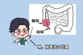阑尾炎VS盲肠炎？5招教你轻松辨别！图片
