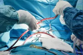 医生多次提醒：一旦做了心脏支架手术，停止做这4件事，以免复发图片