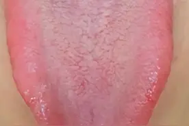 肝不好的时候，别乱用逍遥丸，后果可能比你想的法更加严重！图片