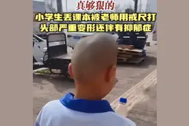 愤怒！学生被教师多次用戒尺殴打导致头部变形，校方回应惹众怒图片