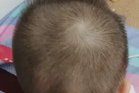 我发现宝宝头顶旋偏右，老人说发旋偏右的孩子比较聪明，真的吗？图片