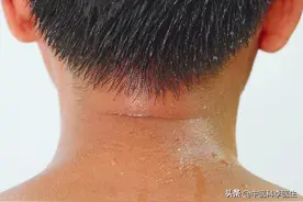 全身老是汗津津，衣服经常湿漉漉，怎么调理？中医六经辨证来解难图片