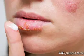 秋天唇裂口干，皮肤干，嗓子干，张锡纯2味药的方子，滋阴又补阳图片