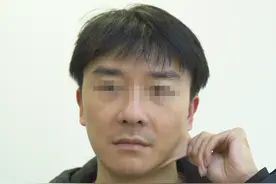 恍然大悟！33岁男主播做完拉皮手术后，才发现这些年白花很多钱！图片