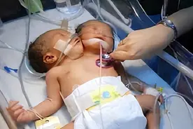 四川孕妇生下中国首例双头女婴，将产检医院告上公堂：赔我50万图片