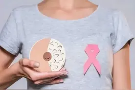 有这几个表现需警惕乳腺癌。这个检查可以早期发现乳腺癌。图片