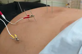 女子俩月减重40斤！中医减肥有点火爆图片