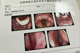 一次做喉镜检查的过程记录图片