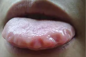 下肢浮肿、湿气太重，一张中医古方，健脾祛湿，温养肾阳图片