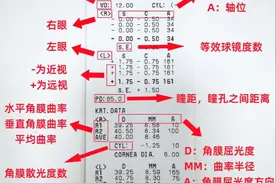 选眼镜避坑指南，一定要记住这五大攻略图片
