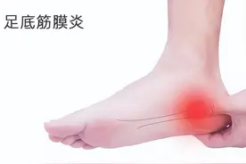 很多人都经受过一种痛，叫足底筋膜炎，医生：这些动作可自行缓解图片