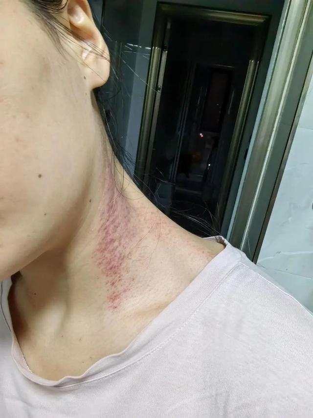 “女护士被男友杀害案”受害人姐姐最新发声：发现多张受害人身体淤青及烫伤自拍照，“父亲一提到我妹就哭”