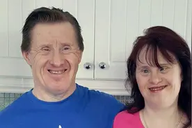 唐氏综合征的孩子应不应该出生？图片