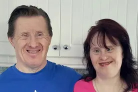 唐氏综合征的孩子应不应该出生？图片