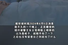 女子误拍了隐翅虫导致皮肤溃烂：差点被毁容！图片