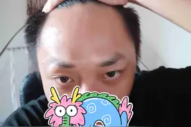 有“聪明相”的孩子通常有4个特点，占一个，都暗示孩子智商高图片