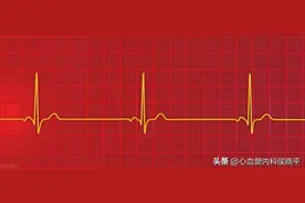 窦性心动过缓是病吗？缓到多少算是病？图片