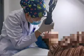 小伙“战痘”6年满脸痘坑羞于见人，医生帮他“填平”凹陷重拾信心图片