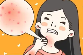 分型治疗，摆脱湿疹这个“磨人精”图片