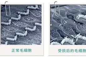 高频区听力更易受损的原因图片