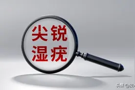 尖锐湿疣会传染吗？图片