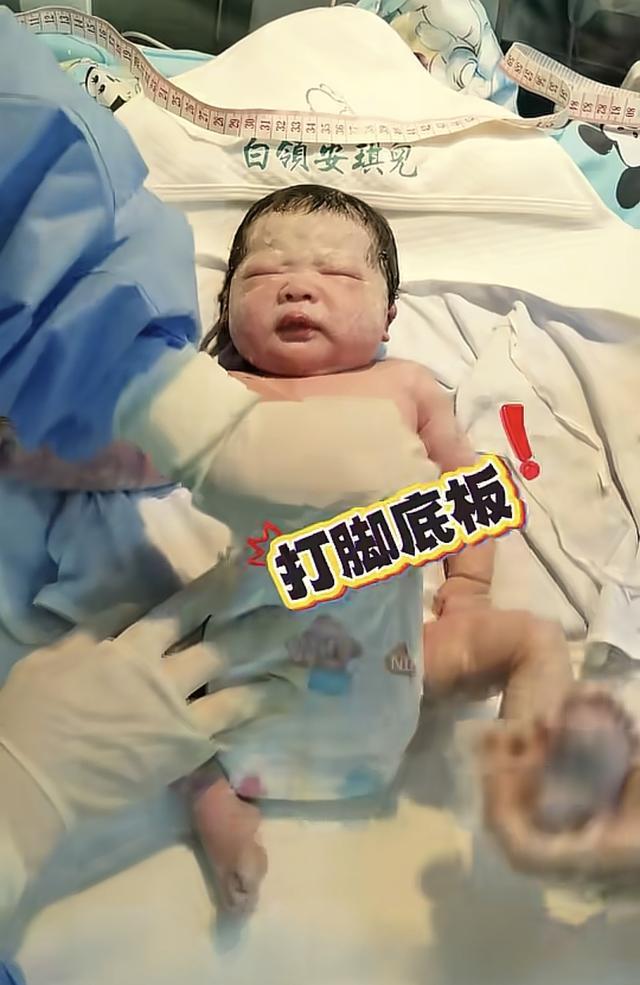 “最惨新生儿”火了，因为太淡定被医生轮番“暴揍”，说好看才哭