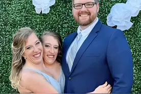 共享身体还能结婚生娃？美国连体双胞胎怀孕，母亲身份成谜！图片